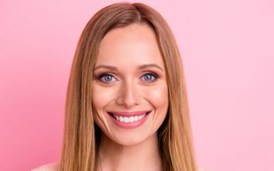 Are Dental Veneers Worth It? 4 Things You Need To Know