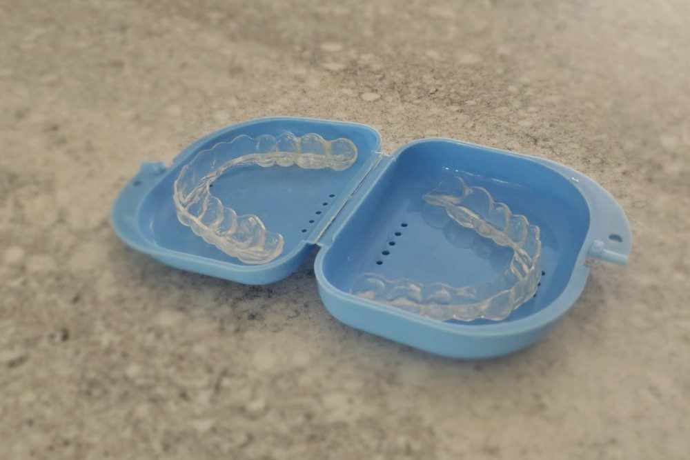 dental splint to prevent bruxism -grinding your teeth