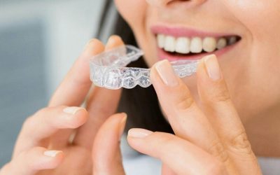 The Complete Guide on How Invisalign Works to Straighten Teeth